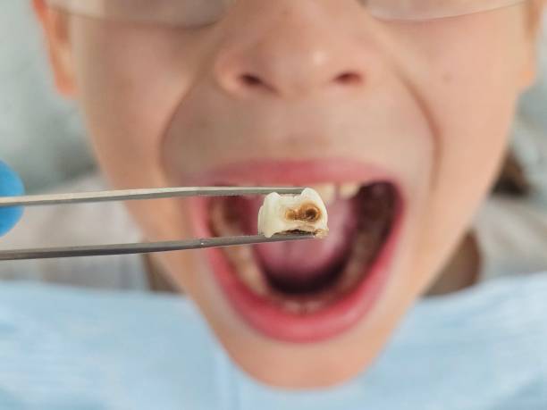 Best Emergency Dental Care for Trauma or Injury in Raymond, WA