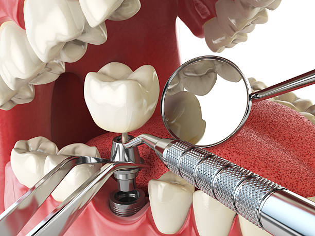 Best Walk-In Emergency Dentist in Raymond, WA